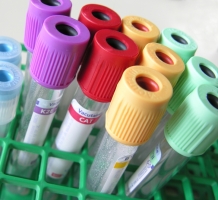 bloodsamples.jpg