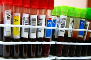 Blood tests