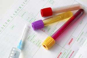Laboratory form and sample vials