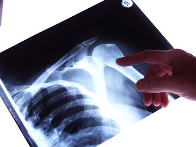x-ray-results